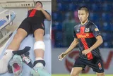 Cầu thủ Việt kiều giá 12 tỷ đồng phải nhập viện gấp sau khi lãnh trọn cú đạp tại trận đấu V.League
