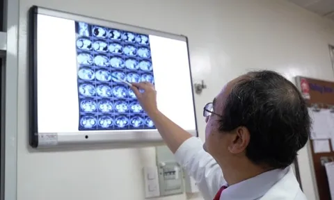 Tưởng chỉ tăng huyết áp, ai ngờ bị u tuyến thượng thận khổng lồ