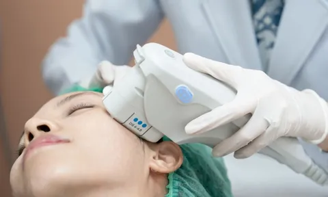Ultherapy PRIME – Chuẩn mực mới của công nghệ nâng cơ không xâm lấn tại Việt Nam
