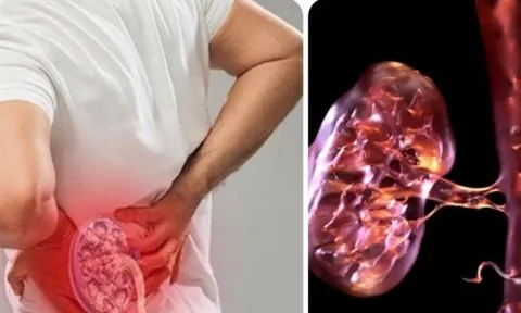 19 dấu hiệu thận yếu bạn không nên bỏ qua