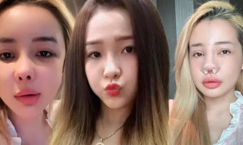 Thì ra đây là gương mặt mà Ngân 98 muốn "đập đi xây lại"