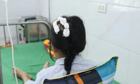 Tình trạng sức khỏe bé gái 9 tuổi bị cha dượng dùng búa đinh đánh vào đầu