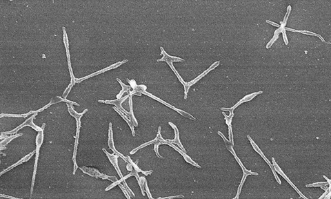 Gia tăng các ca viêm phổi do Mycoplasma, Nhật Bản cảnh báo nguy cơ bùng phát dịch