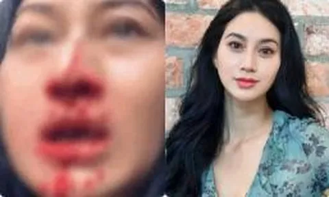 Nữ diễn viên Việt Phi Ngọc Ánh liên tục la hét cầu cứu trong livestream với khuôn mặt đầy máu