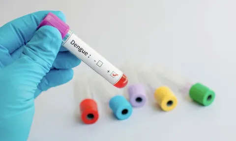 Viện Pasteur TP HCM thử nghiệm vắc-xin sốt xuất huyết trên 4.000 người Việt