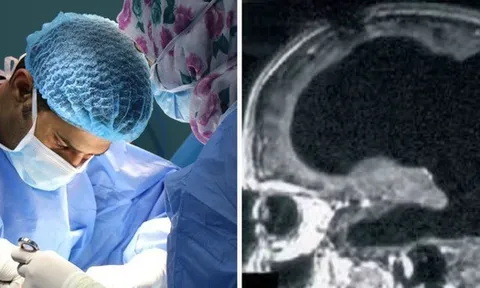 Bí ẩn về người đàn ông mất 90% não, nhưng vẫn có thể sống một cuộc sống bình thường