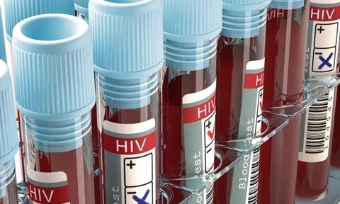 Người phụ nữ nhiễm HIV dù chồng và con gái không hề mắc bệnh: Phân tích virus cho kết quả gây sốc
