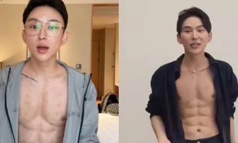 Hot boy chi 14,8 tỷ đồng tiêm axit tạo cơ bụng 8 múi, chuyên gia sợ hãi cảnh báo