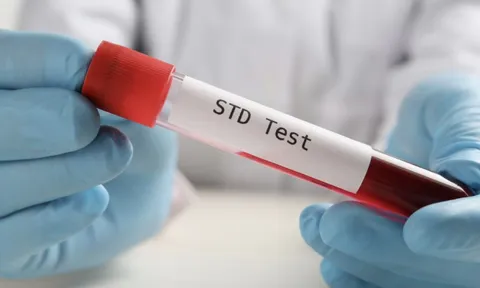 1 bệnh viện ở TP HCM ghi nhận 1 năm hơn 38.000 ca sùi mào gà