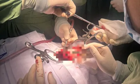 Liệt tứ chi vì một bất cẩn nhỏ