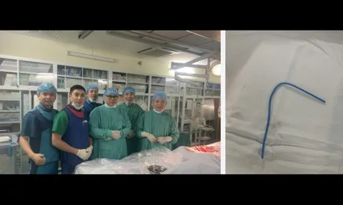 Ống thông truyền hóa chất bị bỏ quên suốt 3 năm, đứt trôi vào tim người phụ nữ