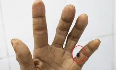 Người phụ nữ 60 tuổi "cứng hàm" suýt mất mạng vì bị gà đá