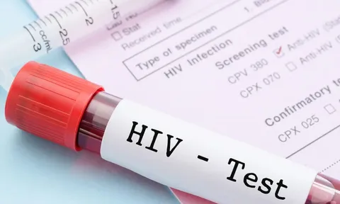 1 thành phố ghi nhận hơn 3.000 ca nhiễm HIV mới trong 9 tháng đầu năm 2025: 81% lây qua con đường này