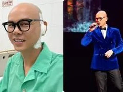 Sao nam khổ sở vì không mọc được tóc, giảm trí nhớ vì ngã từ tầng 3, giờ ra sao?