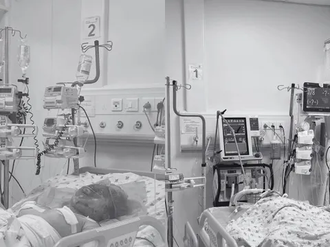 Cha phóng hỏa sau li hôn, 2 con thơ nguy kịch