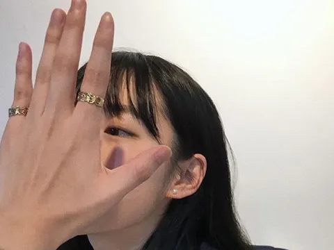 Nổi nhiều gân tay là khỏe hay yếu? Thấy gân xanh nổi rõ ở 6 nơi này trên cơ thể tức trong người đầy bệnh