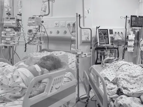 Hai chị em nguy kịch do cha ruột phóng hỏa đốt phòng trọ