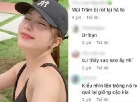 Thiều Bảo Trâm lên tiếng trước nghi vấn bị biến chứng hậu 'dao kéo'