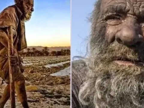 Vì sao "người đàn ông bẩn nhất thế giới" lại qua đời ngay sau khi tắm lần đầu tiên?