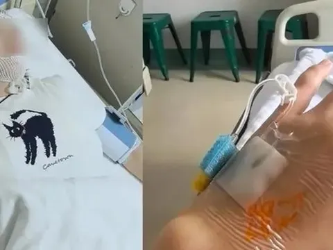 Dầm mưa 10 phút, người phụ nữ bị viêm màng não