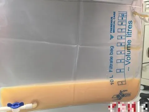 Máu trắng đục như sữa vì chủ quan với 1 việc: Bác sĩ tức giận, nói "chẳng khác nào tự bơm mỡ vào máu”