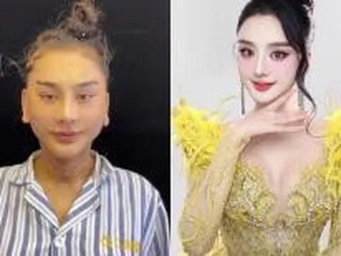 Lâm Khánh Chi phản ứng thế nào khi bị nói 'nghiện dao kéo' quá đà?