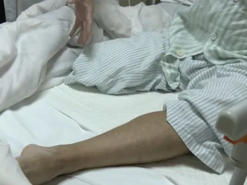 Người đàn ông bất ngờ phải cắt cụt bắp chân: Bác sĩ nói do chủ quan với 1 dấu hiệu bất thường