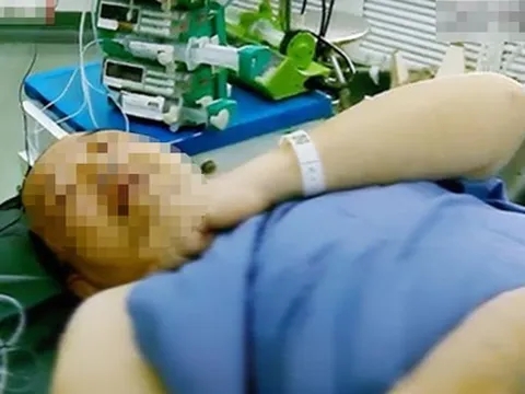 Mắc bệnh tim sau 1 năm chạy bộ mỗi sáng, nguyên nhân gây bất ngờ