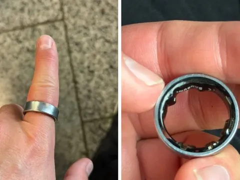 Người dùng hốt hoảng khi một sản phẩm của Samsung phồng pin, kẹt luôn trên ngón tay: "Vừa đau vừa sợ nổ"