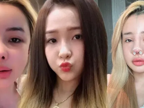 Thì ra đây là gương mặt mà Ngân 98 muốn "đập đi xây lại"