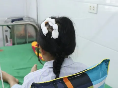 Tình trạng sức khỏe bé gái 9 tuổi bị cha dượng dùng búa đinh đánh vào đầu