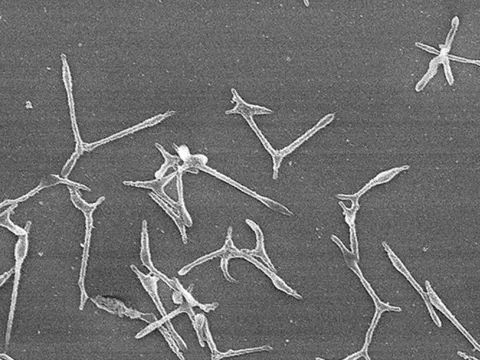 Gia tăng các ca viêm phổi do Mycoplasma, Nhật Bản cảnh báo nguy cơ bùng phát dịch