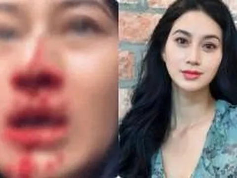 Nữ diễn viên Việt Phi Ngọc Ánh liên tục la hét cầu cứu trong livestream với khuôn mặt đầy máu