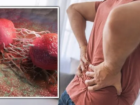 Ngày càng nhiều nam giới mắc ung thư tuyến tiền liệt: Thấy những dấu hiệu này thì làm ơn đừng bỏ qua