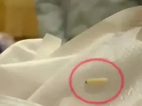 Một thương hiệu băng vệ sinh bị bóc mẽ sản phẩm có chứa “sâu sống bò lúc nhúc”