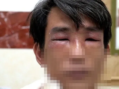 TP HCM vào mùa kiến ba khoang: cảnh báo người dân kiểm tra chăn màn