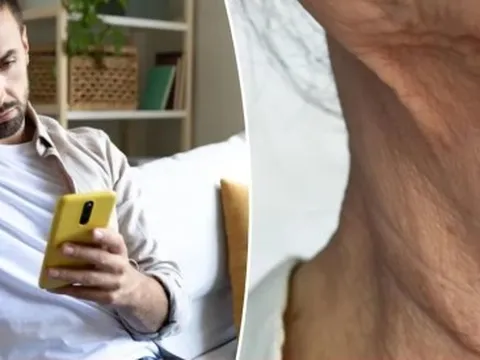 Những người trẻ da nhăn nheo, cổ chảy xệ do suốt ngày cắm mặt vào điện thoại