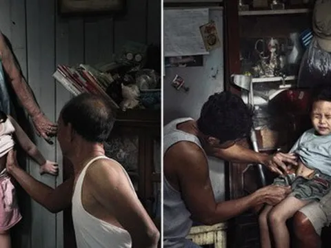 Bộ ảnh gây chấn động: "Nỗi đau theo suốt một đời"
