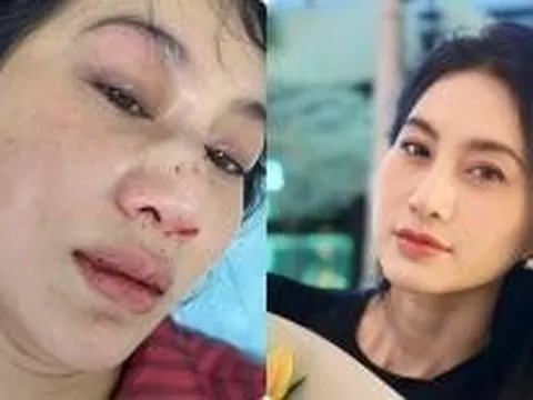 Nữ diễn viên livestream máu me vì bị chồng đánh nay lại xin lỗi