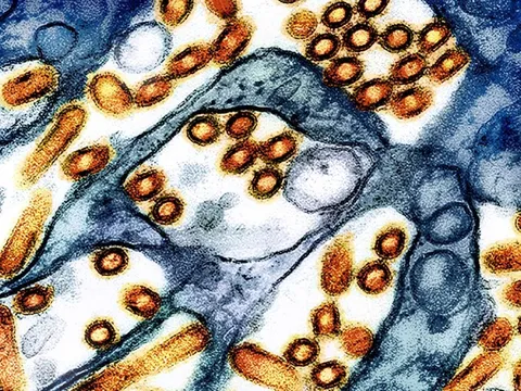 Phát hiện chủng virus cúm gia cầm chưa từng thấy ở người tại Mỹ