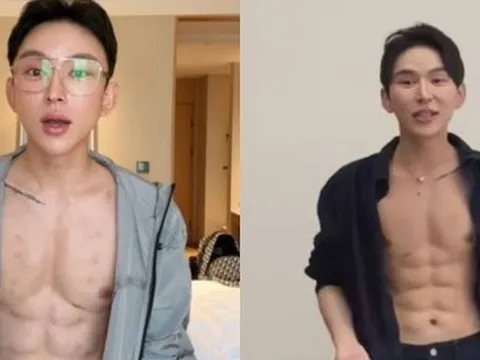 Hot boy chi 14,8 tỷ đồng tiêm axit tạo cơ bụng 8 múi, chuyên gia sợ hãi cảnh báo