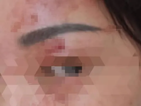 Người phụ nữ bỏng giác mạc vì làm 1 việc khi giặt đồ