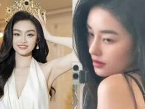 Nhận không ra nhan sắc của Hoa hậu Yến Nhi sau khi can thiệp thẩm mỹ