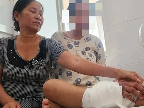 Tin vui với cô gái trẻ mang song thai bị tai nạn lao động phải ghép bàn tay vào chân