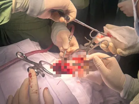 Liệt tứ chi vì một bất cẩn nhỏ