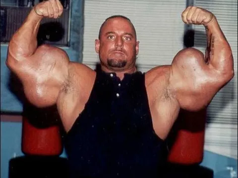 VĐV thể hình sở hữu “cánh tay quái dị” nhất thế giới, sự thật phía sau khiến tất cả ngỡ ngàng