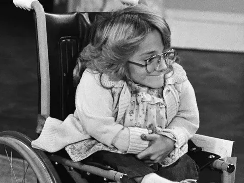 Diễn viên Melanie Watson mắc bệnh xương thủy tinh qua đời ở tuổi 57