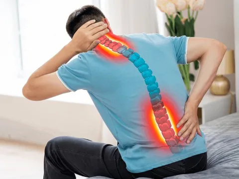 Ngày càng nhiều người trẻ 20–30 tuổi xương khớp đã như người già: Bác sĩ cảnh báo tất cả đều có lý do