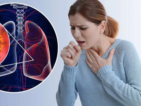 9 dấu hiệu ung thư phổi giai đoạn đầu thường bị bỏ qua